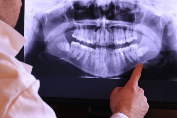 Best Emergency Dentist for Special Needs Patients in Trevorton, PA