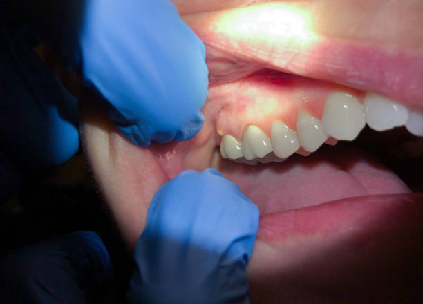 Best Emergency Root Canal Treatment in Trevorton, PA