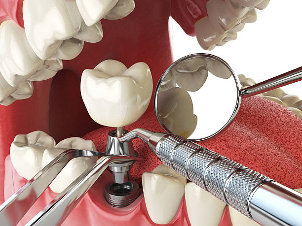 Best Broken or Cracked Tooth Emergency Dentist in Trevorton, PA